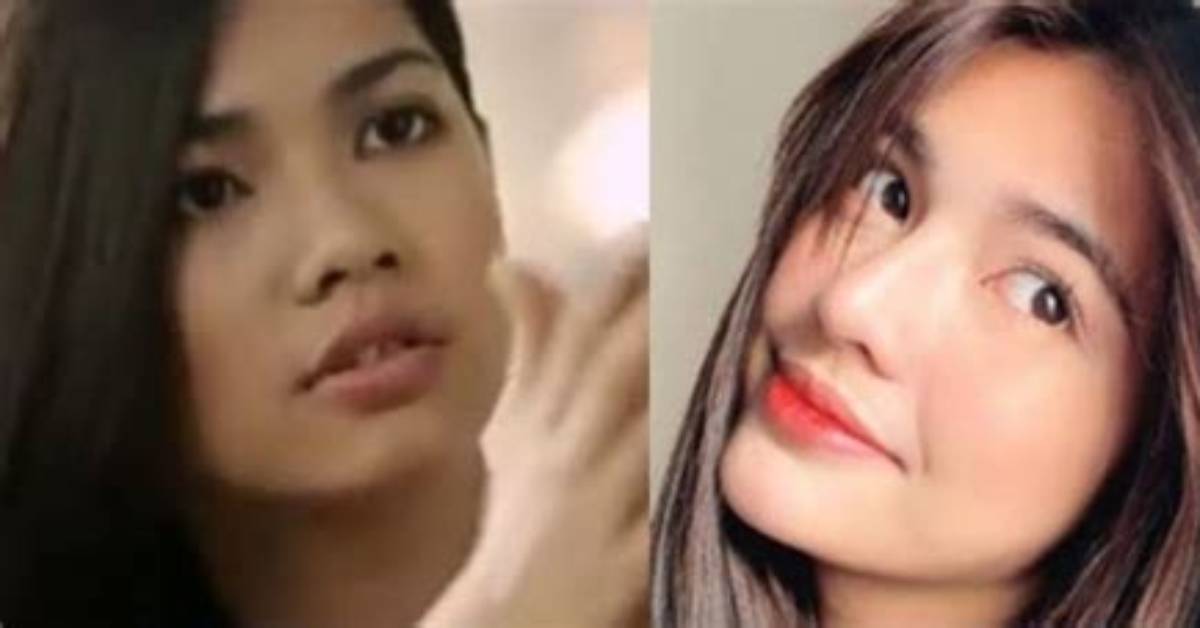 Actress Jane De Leon Plastic Surgery Details – See Her Old Pictures on Instagram