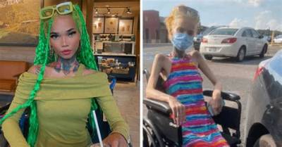 All About Ig Model Gena Tew: Aids Diagnosis Update