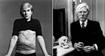Andy Warhol Cause of Death