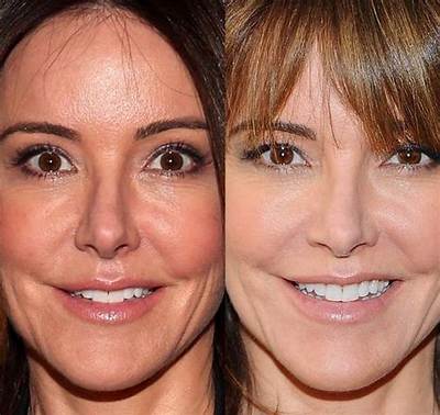 Christa Miller Plastic Surgery: What Happened to Her Face in Head of the Class?
