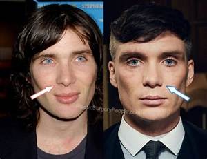 Cillian Murphy Nose: Did He Underwent Surgery? Before and After Pics