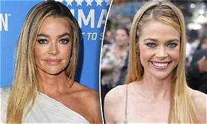 Denise Richards Before Plastic Surgery! Who Is Denise Richards? Denise Richards Wikipedia, Age, Height, Husband, and Net Worth