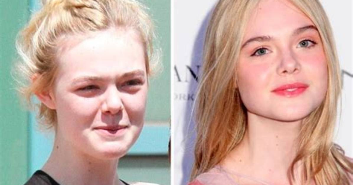 Did Elle Fanning Undergo Surgery? Find the Actress’ Before and After Pictures