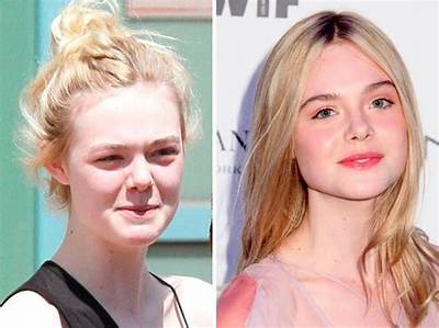 Did Elle Fanning Undergo Surgery? Find the Actress’ Before and After Pictures