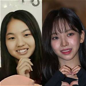 Did Karina Aespa Undergo Plastic Surgery? Find Her Before and After Pictures
