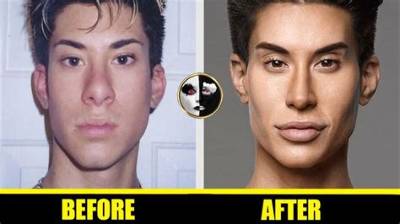 Did Mateo Blanco Have Plastic Surgery? Before and After Photos on Instagram -Details to Know