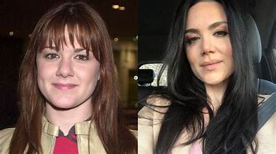 Did Vanessa Amorosi Do a Nose Job? Plastic Surgery Rumors of the Australian Singer