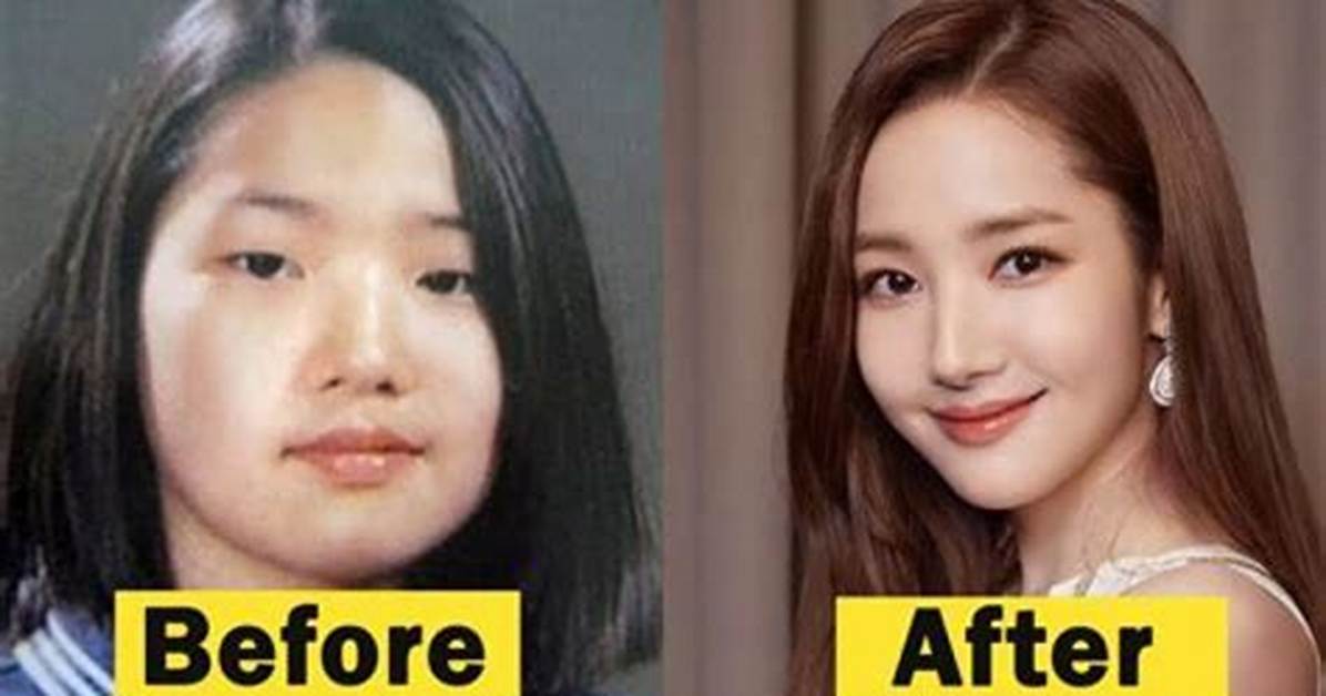 Did Yeonmi Park Had a Plastic Surgery? Is She Fake? Husband, Son and Instagram