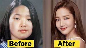 Did Yeonmi Park Had a Plastic Surgery? Is She Fake? Husband, Son and Instagram