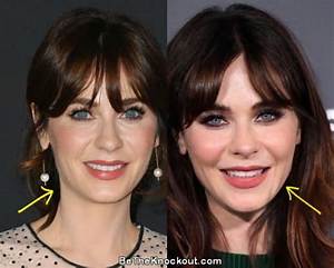 Did Zooey Deschanel Get a Plastic Surgery? Facts Behind the Rumors