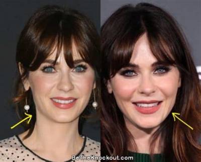 Did Zooey Deschanel Get a Plastic Surgery? Facts Behind the Rumors
