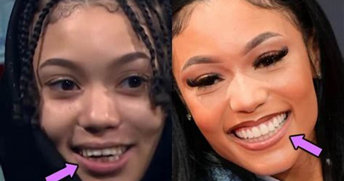 Explore Photos of Coi Leray Teeth Before and After Braces -Changes Debunked!