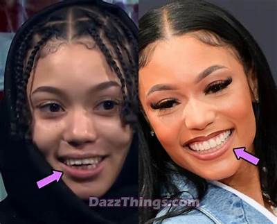 Explore Photos of Coi Leray Teeth Before and After Braces -Changes Debunked!