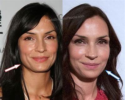 Famke Janssen’s Plastic Surgery: Did the Poison Rose Cast Have Botox, Fillers, and a Facelift as Fans Claim? Look at the Before and After Pictures!