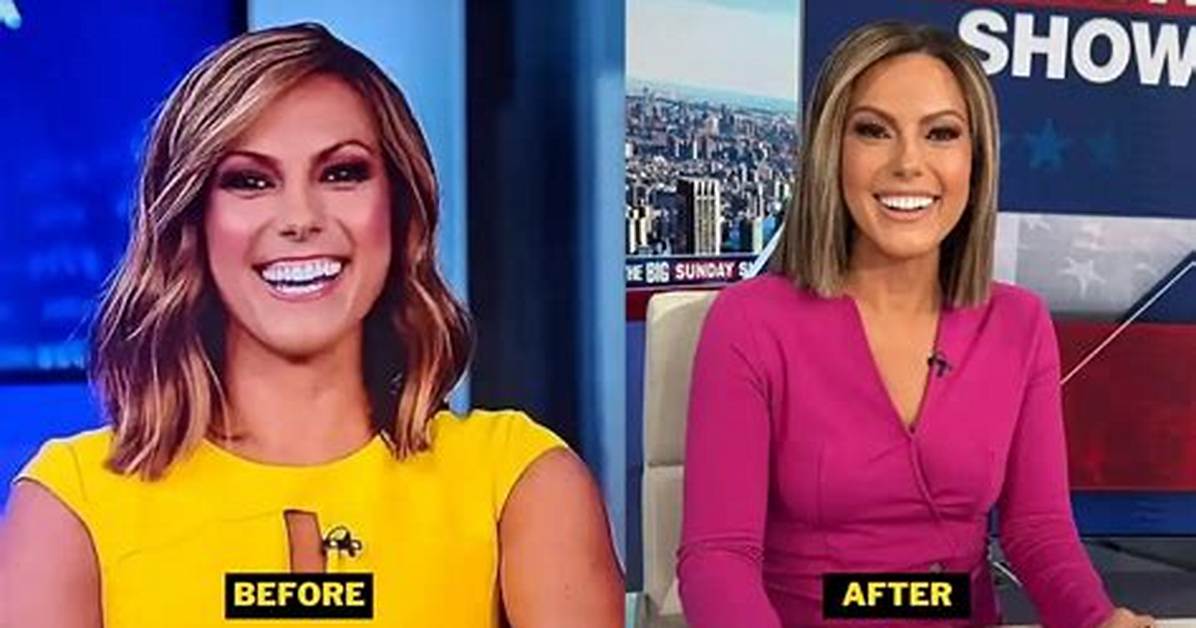 Fox News Lisa Boothe Plastic Surgery – Watch Before and After Pictures