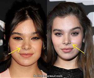 Hailee Steinfeld Plastic Surgery: Did She Get a Nose Job? Her Secret to Weight Loss Revealed