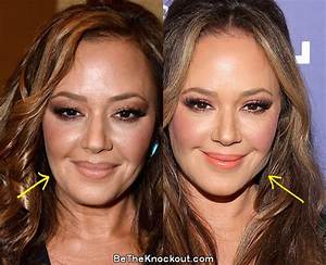 Has Leah Remini Had Plastic Surgery? What Happened to Her Face?