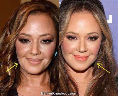 Has Leah Remini Had Plastic Surgery? What Happened to Her Face?