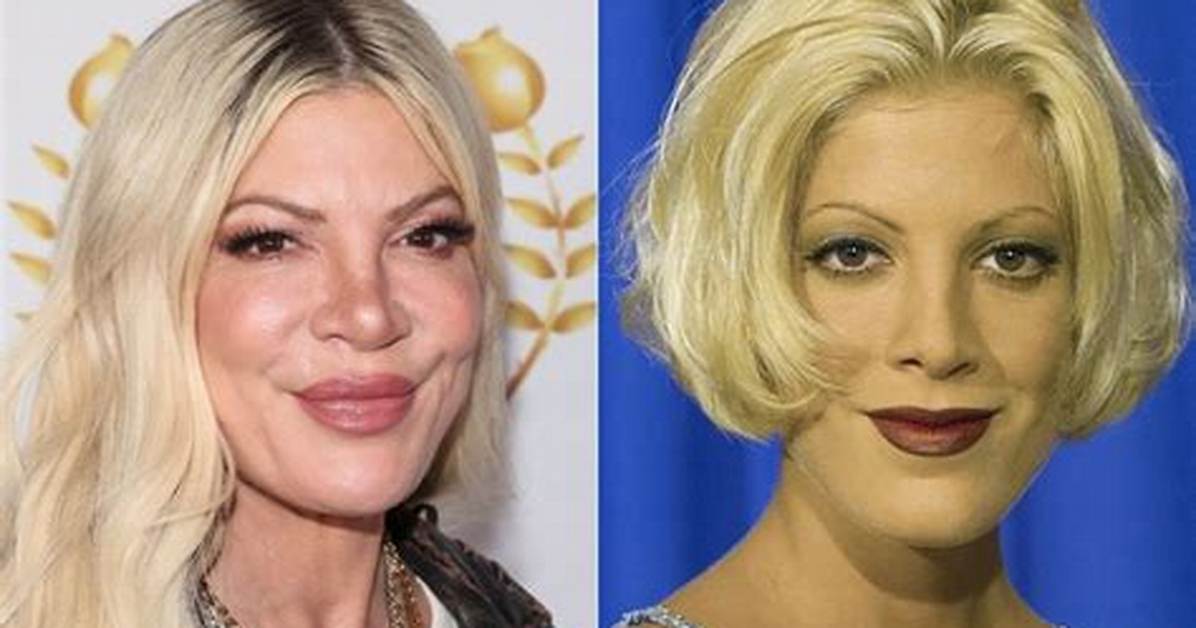 Has Tori Spelling Gained Weight? Face Surgery Then & Now Photos on Instagram -Details to Know