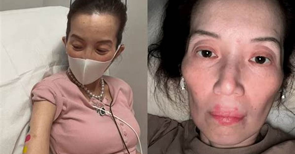 Hiv: What Happened to Kris Aquino? Weight Loss and Health Problems -Details to Know