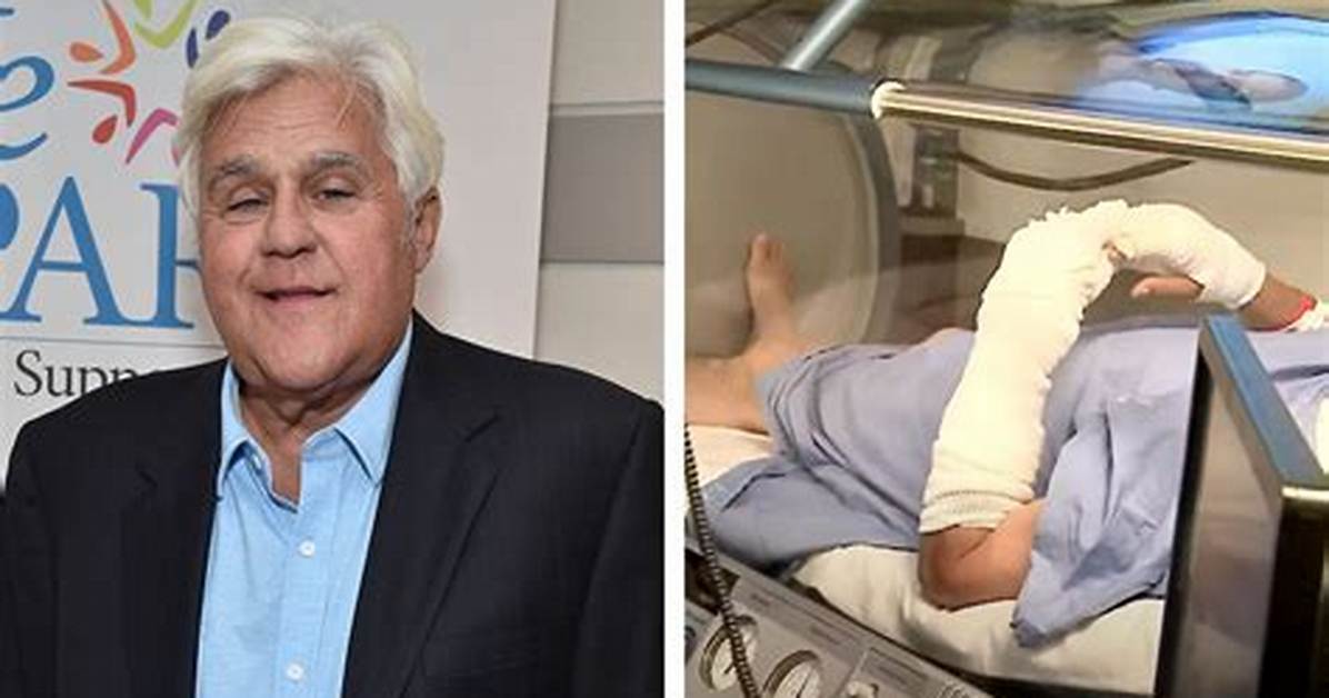 How Did Jay Leno’s Accident Happen?