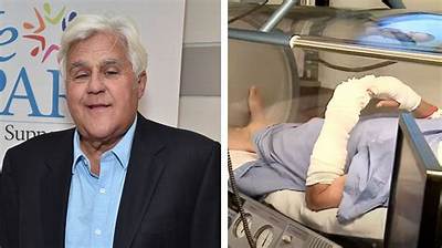 How Did Jay Leno’s Accident Happen?