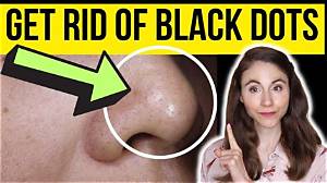 How to Get Rid of Black Stuff in Cats Ears