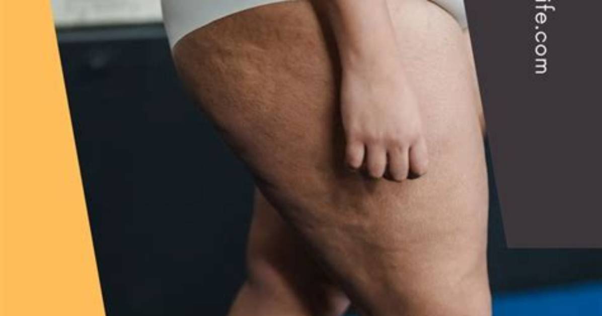 How to Get Rid of Flabby Thighs