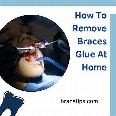 How to Remove Braces Glue