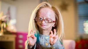 Is Adalia Rose Still Alive or Dead? Wikipedia and Age – as a Baby Photos