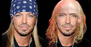 Is Bret Michaels Bald Without Wig, What Happened to His Hair? Before and After Pics