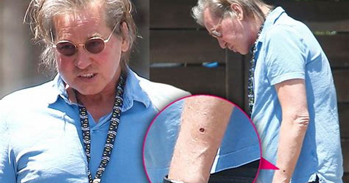 Is Val Kilmer Still Suffering from Cancer? His Health Update
