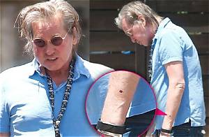 Is Val Kilmer Still Suffering from Cancer? His Health Update