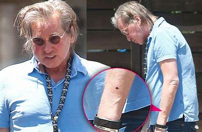 Is Val Kilmer Still Suffering from Cancer? His Health Update