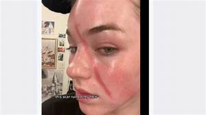Jentri Wallace’s Scar: What Happened to Her Face? Was It an Accident?