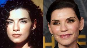 Julianna Margulies Doesn’t Look Natural After Plastic Surgery!
