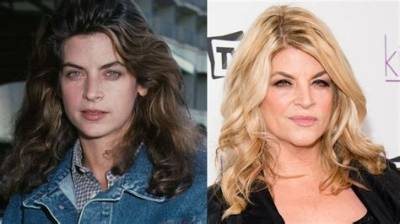Kirstie Alley’s Plastic Surgery: Did the Cheers Star Have Botox and a Facelift?