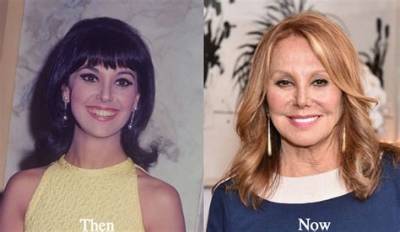 Know About Marlo Thomas Face Lift: Plastic Surgery Before and After, Kids and Husband