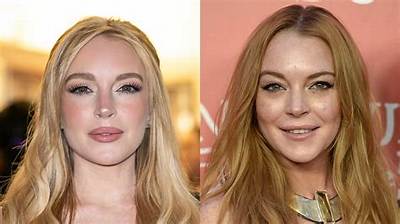 Lindsay Lohan’s Plastic Surgery: Fillers, Nose Job, Eye Lift & More!