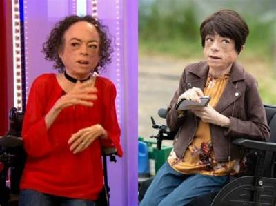 Liz Carr Height, Age, Boyfriend, Biography, Wiki, Net Worth