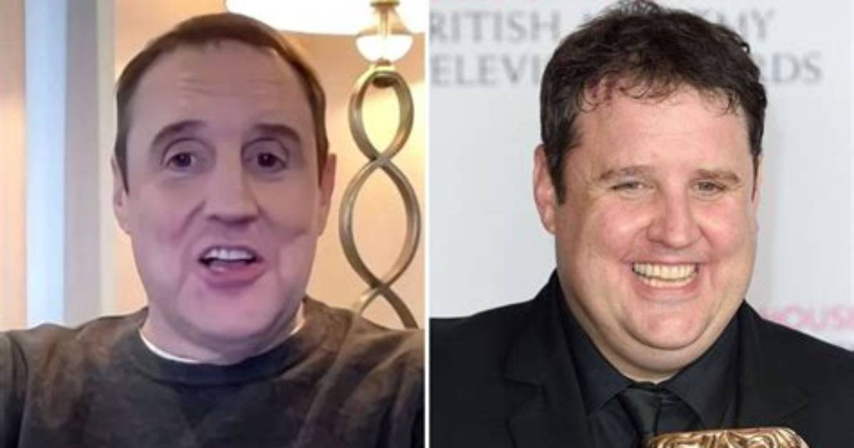Peter Kay Massive Hair Loss Because of Cancer, Weight Loss and Illness Update