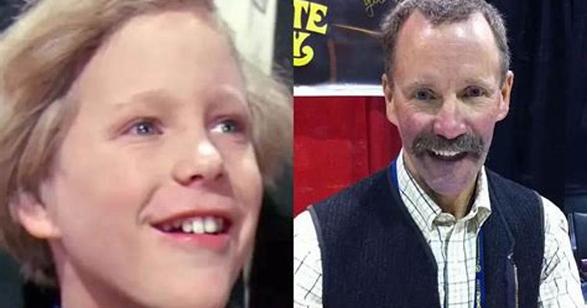 Peter Ostrum Teeth: Charlie Bucket Tooth Images – Is It Fixed Now?