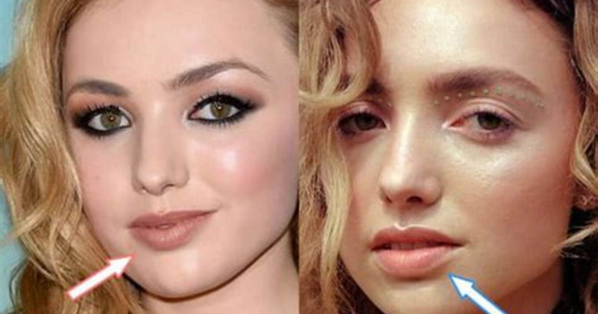 Peyton List Plastic Surgery: Before and After Photos
