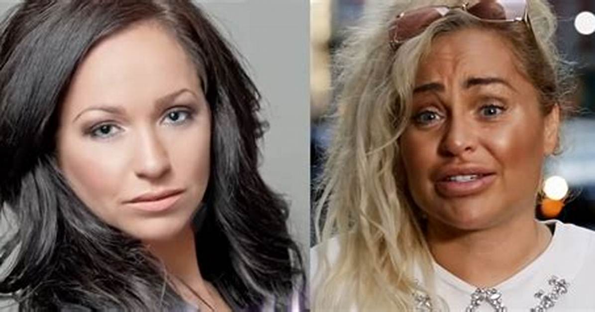 Pictures: Darcey and Stacey Before and After Plastic Surgery? Parents Nationality & Ethnicity