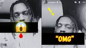 Rapper Leak Sosa Stabbed: Left a Dreadful Cut on His Face