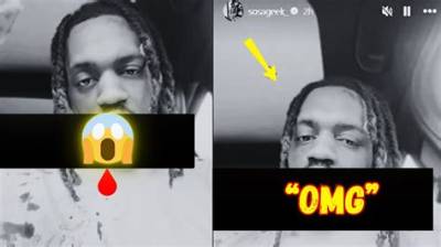 Rapper Leak Sosa Stabbed: Left a Dreadful Cut on His Face