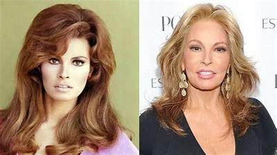 Raquel Welch’s Plastic Surgery: Did the Actress Have Cosmetic Surgery to Look Young? Did She Have Breast Implants?