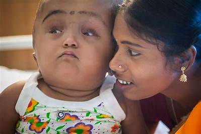 Roona Begum Wikipedia: Baby Roona Death: How Did She Die?