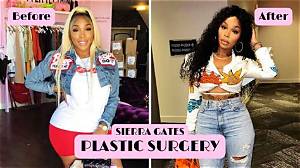 Sierra Gates Before Plastic Surgery – Is She Related to Kevin Gates?