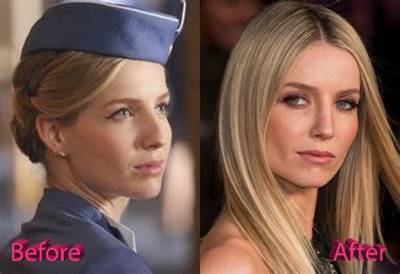 Truth About Annabelle Wallis Nose Job